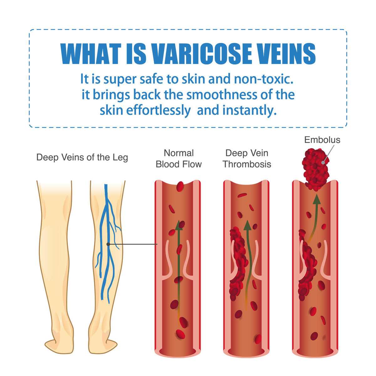 Venous Repair Cream To Ease The Veins Massage
