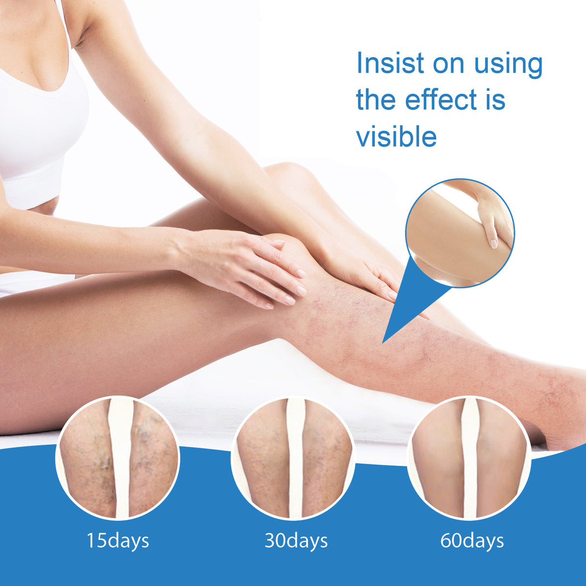 Venous Repair Cream To Ease The Veins Massage
